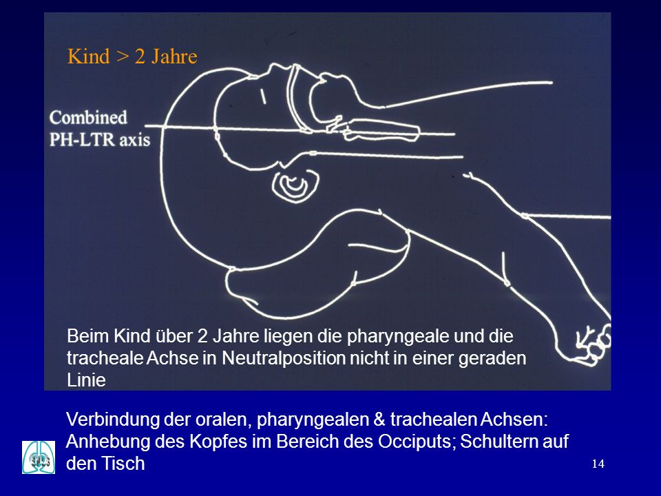 Wie den Nagelzwang ohne Operation Videos zu heilen